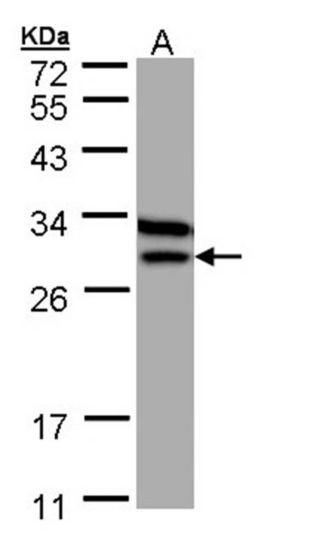 Anti-Beta-ETF Antibody