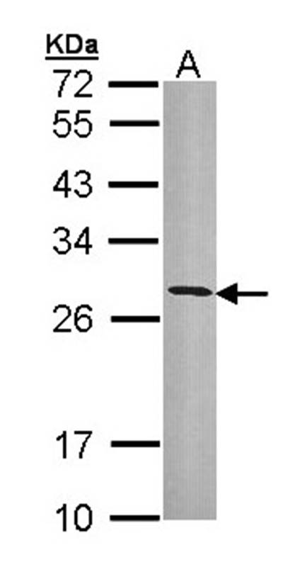 Anti-HLA-DRB3 Antibody
