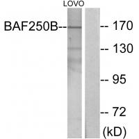 Anti-BAF250B Antibody