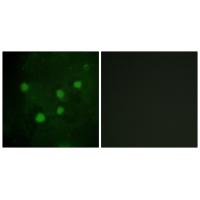 Anti-BAF250B Antibody Anti-BAF250B Antibody