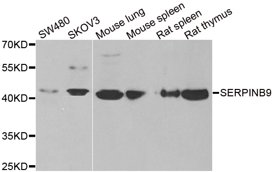 Anti-SERPINB9 Antibody