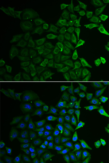 Anti-C21orf33 Antibody Anti-C21orf33 Antibody