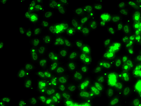 Anti-SECISBP2 Antibody