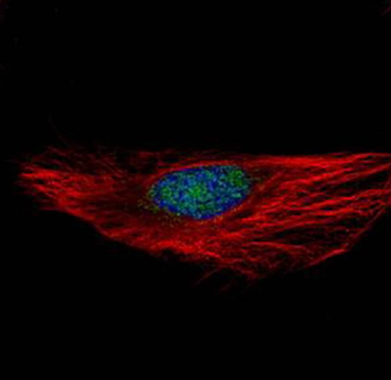 Anti-RNA binding motif protein 28 Antibody Anti-RNA binding motif protein 28 Antibody