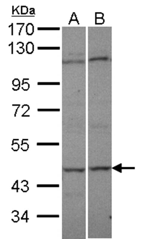 Anti-C9orf98 Antibody