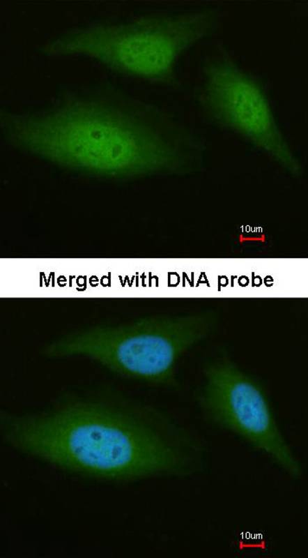 Anti-C9orf98 Antibody Anti-C9orf98 Antibody