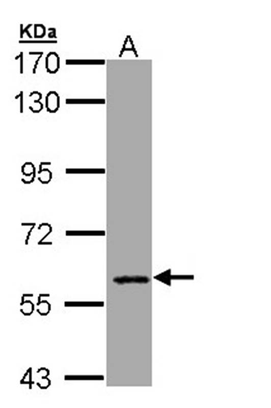 Anti-CBFA2T2 Antibody