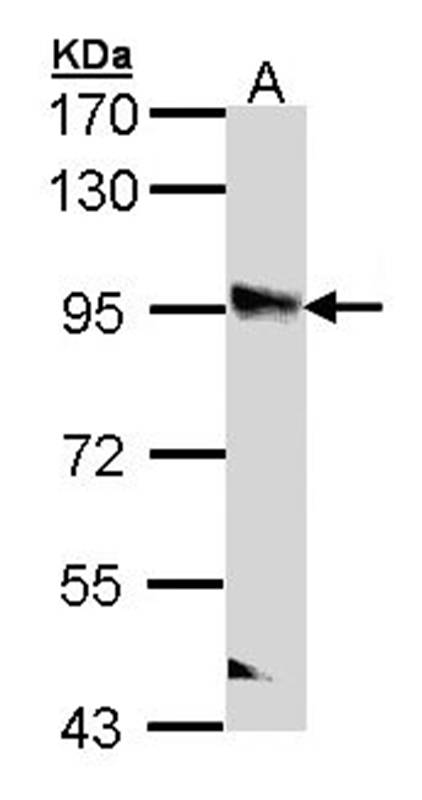 Anti-PPFIBP2 Antibody