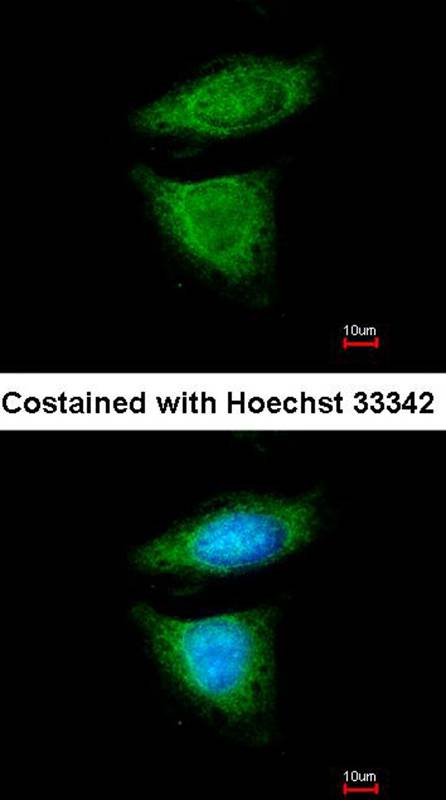 Anti-DYNC1I2 Antibody Anti-DYNC1I2 Antibody
