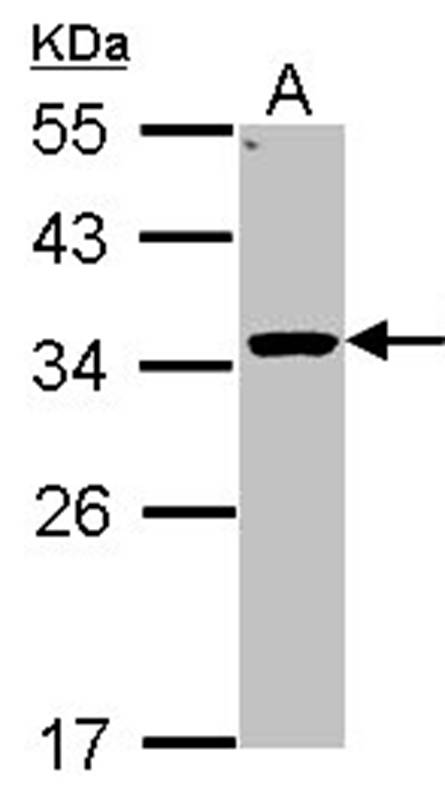 Anti-HSD11B1 Antibody