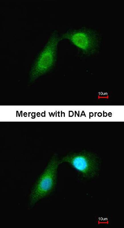 Anti-DCAMKL2 Antibody Anti-DCAMKL2 Antibody
