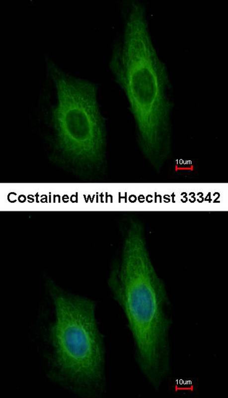 Anti-DNase I Antibody Anti-DNase I Antibody