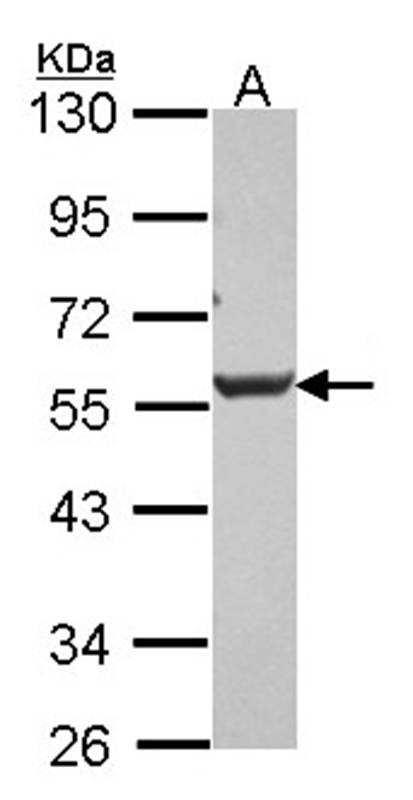 Anti-Dkk-3 Antibody