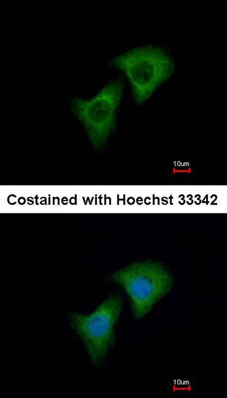 Anti-Dkk-3 Antibody Anti-Dkk-3 Antibody