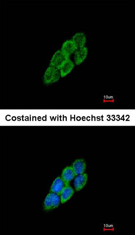 Anti-LTBP-4 Antibody Anti-LTBP-4 Antibody