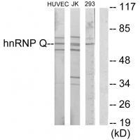 Anti-hnRNP Q Antibody