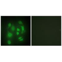 Anti-hnRNP Q Antibody Anti-hnRNP Q Antibody