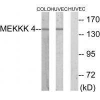 Anti-MEKKK 4 Antibody
