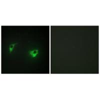 Anti-MEKKK 4 Antibody Anti-MEKKK 4 Antibody