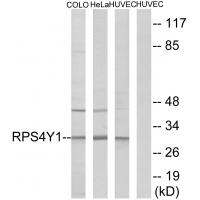 Anti-RPS4Y1 Antibody