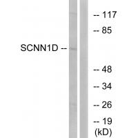 Anti-SCNN1D Antibody