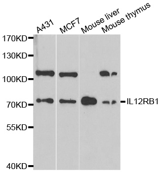 Anti-IL12RB1 Antibody