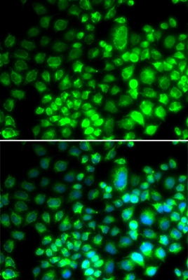 Anti-ST6GAL1 Antibody