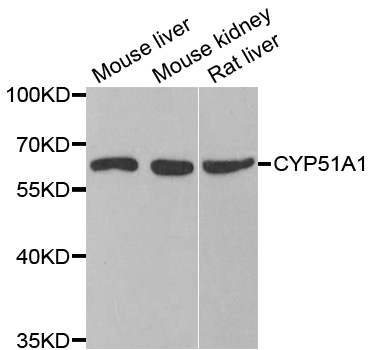 Anti-CYP51A1 Antibody