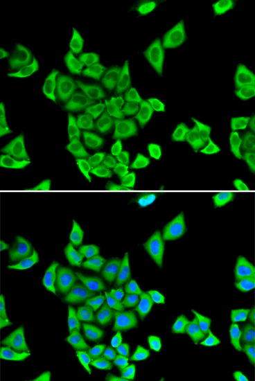 Anti-CIAPIN1 Antibody Anti-CIAPIN1 Antibody