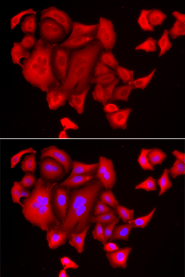 Anti-SLC26A2 Antibody