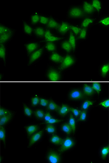 Anti-POU2AF1 Antibody Anti-POU2AF1 Antibody