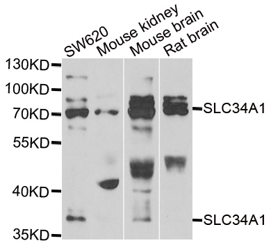 Anti-SLC34A1 Antibody
