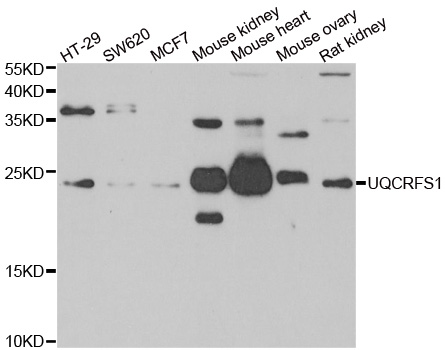 Anti-UQCRFS1 Antibody