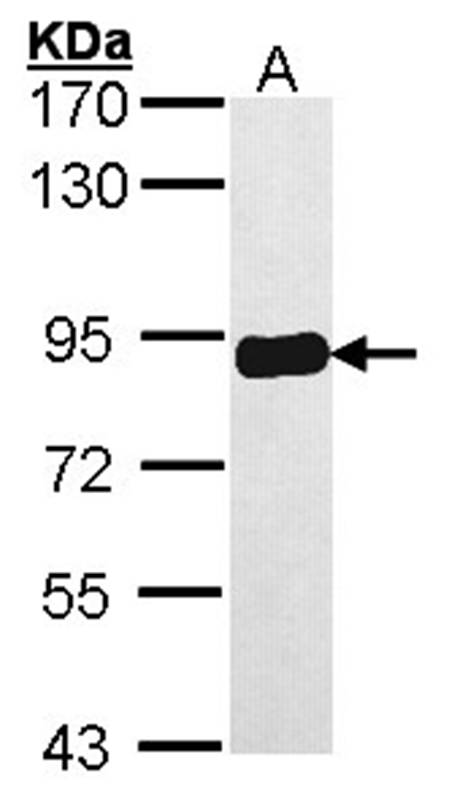 Anti-PRKCSH Antibody