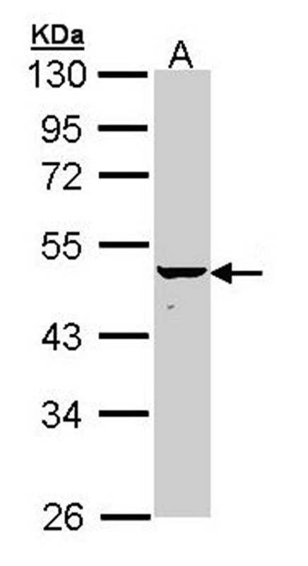 Anti-KRTHA4 Antibody