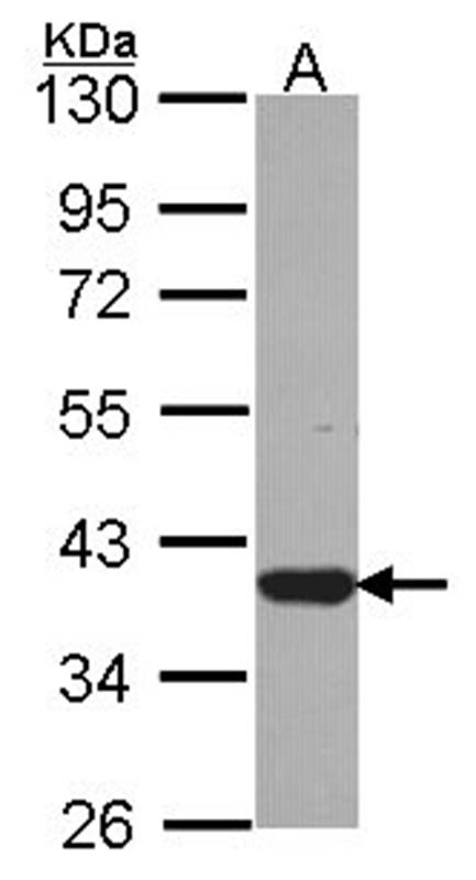 Anti-LZTFL1 Antibody