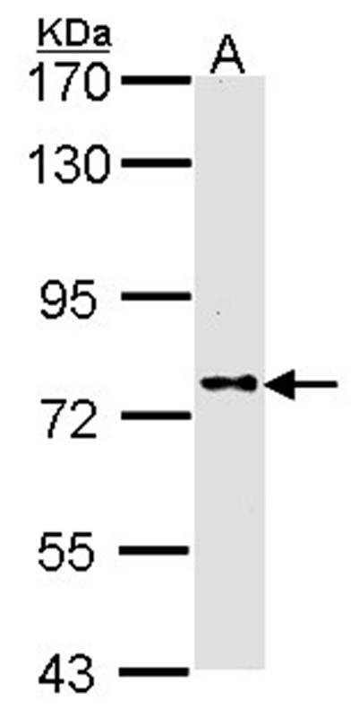Anti-DPRP1 Antibody