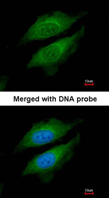 Anti-DPRP1 Antibody Anti-DPRP1 Antibody