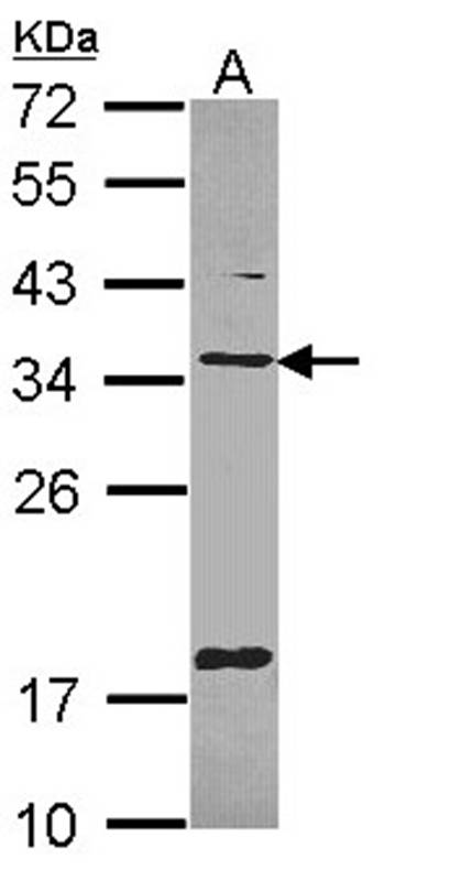 Anti-TXNDC1 Antibody