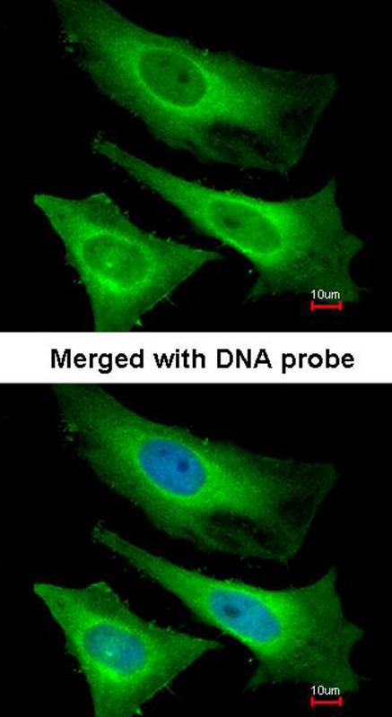 Anti-TNNI3K Antibody Anti-TNNI3K Antibody