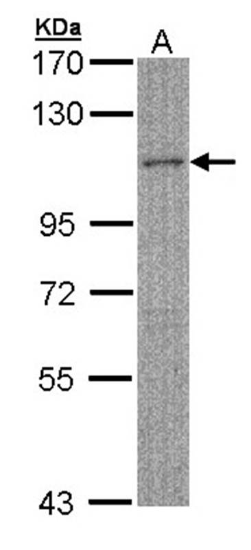 Anti-MYBPC2 Antibody
