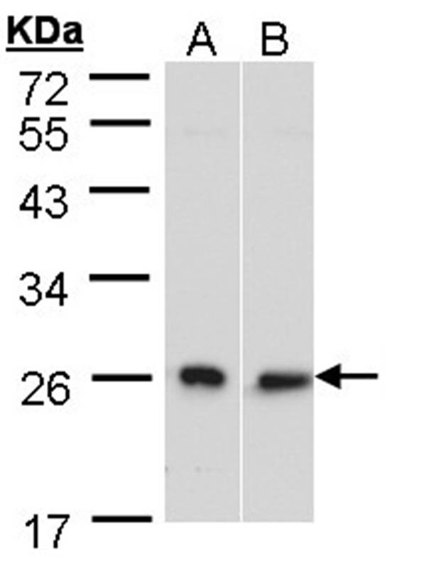 Anti-DNAJB6 Antibody