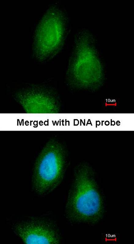 Anti-SEPHS2 Antibody Anti-SEPHS2 Antibody