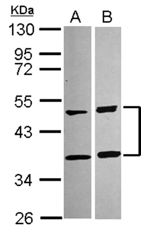 Anti-SQSTM1 Antibody