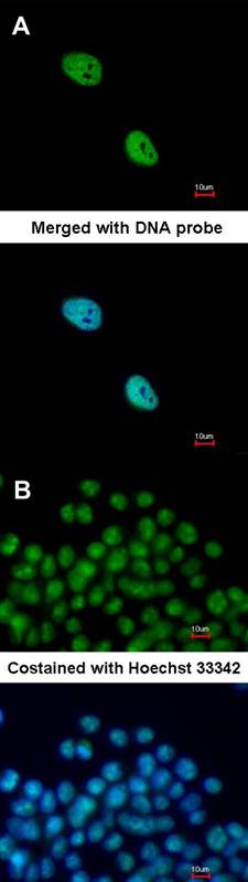 Anti-NKX2-5 Antibody Anti-NKX2-5 Antibody
