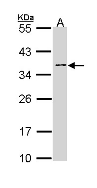 Anti-NAGAT Antibody