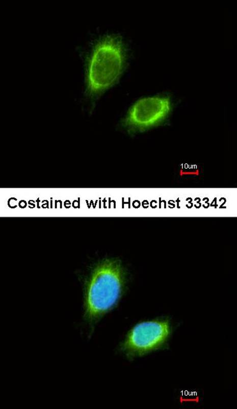 Anti-NAGAT Antibody Anti-NAGAT Antibody