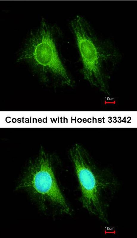 Anti-UGT2B7 Antibody Anti-UGT2B7 Antibody