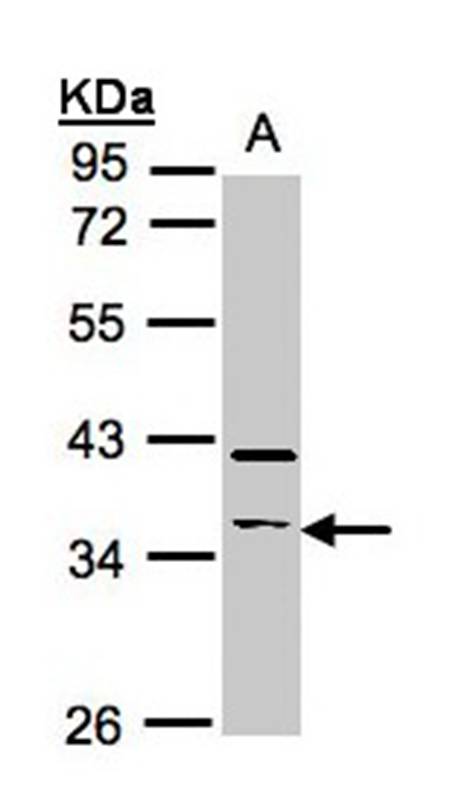 Anti-RASSF2 Antibody