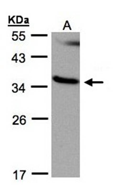 Anti-RASSF1 Antibody